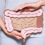 Fettreiche Ernährung und Darmkrebs: Aktuelle Erkenntnisse und 5 Präventionstipps