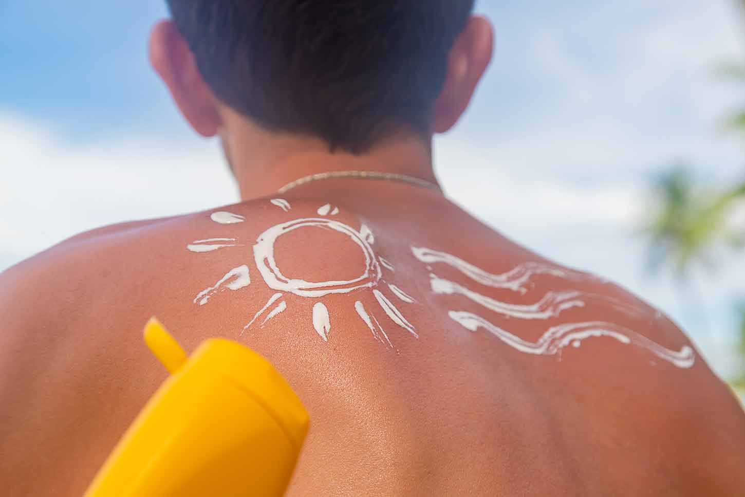 hautkrebs-durch-sonnenbrand-vorbeugen